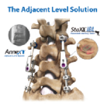 Annex Adjacent Level System