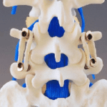 Graf Ligament