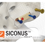 SICONUS
