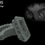 POROS Trabecular Cage