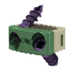 AVS Anchor®-C Cervical Cage System