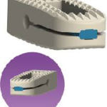 LorX® Expandable