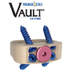 Vault