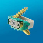 LONESTAR® Cervical Stand Alone