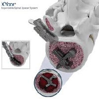 XYcor Expandable Spinal Spacer System