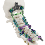 QUARTEX™ Occipito-Cervico-Thoracic (OCT) Stabilization System