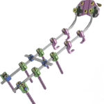 VERTEFIX C