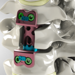 CORPEX P