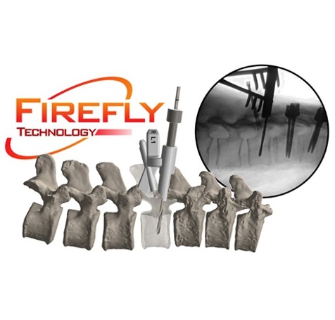 MightyOak_Firefly