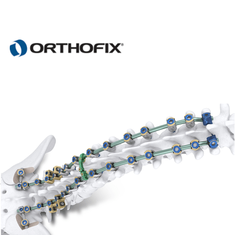 Orthofix Announces Full Commercial Launch And First Patient Cases Of ...